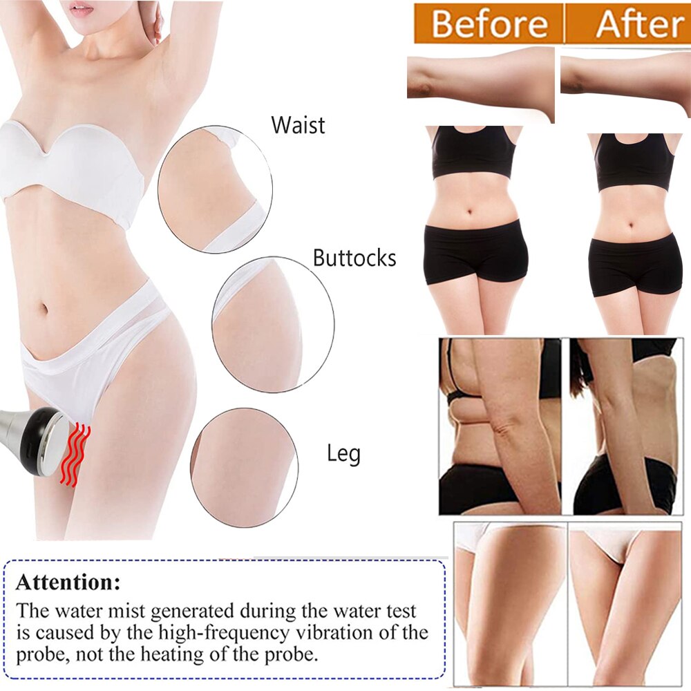 Metal Head 40K Cavitation Ultrasonic Body Slimming Machine Weight Loss Facial Radio Frequency Skin Tightening Beauty Device